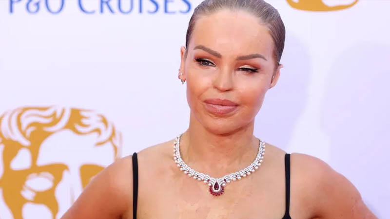 Katie Piper