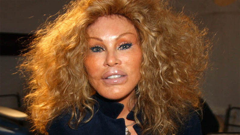 Jocelyn Wildenstein